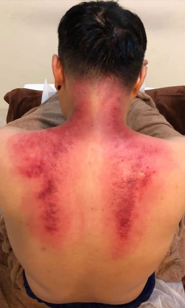 True Massage 客製化筋絡按摩客戶好評推薦